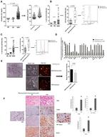 CD68 Antibody in Immunohistochemistry (IHC)