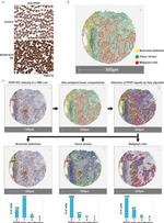 PFKP Antibody in Immunohistochemistry (IHC)