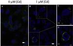 CTR1 Antibody in Immunocytochemistry (ICC/IF)