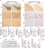 IBA1 Antibody in Immunohistochemistry (IHC)