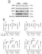 MYO7A Antibody in Western Blot (WB)