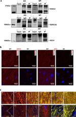 VDAC2 Antibody in Immunoprecipitation (IP)