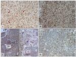 FADS2 Antibody in Immunohistochemistry (IHC)