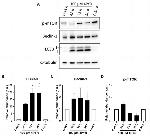 LC3B Antibody in Western Blot (WB)