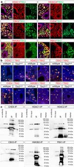 HP1 gamma Antibody in Immunocytochemistry, Immunohistochemistry (Paraffin) (ICC/IF, IHC (P))