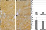 beta Amyloid Antibody in Immunohistochemistry (IHC)