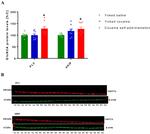 NMDAR2A Antibody in Western Blot (WB)