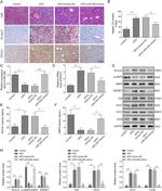 ROCK1 Antibody in Immunohistochemistry (IHC)