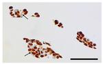 Survivin Antibody in Immunohistochemistry (IHC)