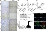 NFATC1 Antibody in Western Blot, Immunocytochemistry, Immunohistochemistry (WB, ICC/IF, IHC)