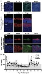 HLA-G Antibody in Immunohistochemistry (Paraffin) (IHC (P))