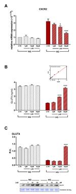 GLUT4 Antibody in Western Blot (WB)