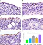 OCT4 Antibody in Immunohistochemistry (IHC)