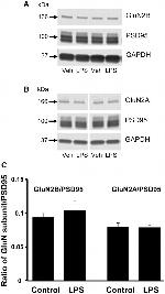 NMDAR2A Antibody in Western Blot (WB)