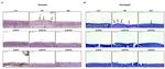 Periostin Antibody in Immunohistochemistry (IHC)