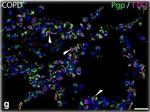 Mouse IgG (H+L) Cross-Adsorbed Secondary Antibody in Immunohistochemistry (IHC)