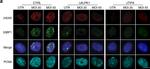 Mouse IgG (H+L) Highly Cross-Adsorbed Secondary Antibody in Immunocytochemistry (ICC/IF)