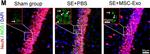 Rabbit IgG (H+L) Highly Cross-Adsorbed Secondary Antibody in Immunohistochemistry (IHC)