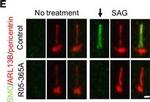 Rabbit IgG (H+L) Highly Cross-Adsorbed Secondary Antibody in Immunohistochemistry (IHC)