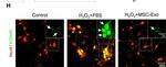 Rabbit IgG (H+L) Highly Cross-Adsorbed Secondary Antibody in Immunohistochemistry (IHC)