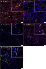 Rabbit IgG (H+L) Highly Cross-Adsorbed Secondary Antibody in Immunocytochemistry (ICC/IF)