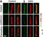 Rabbit IgG (H+L) Highly Cross-Adsorbed Secondary Antibody in Immunohistochemistry (IHC)