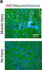 Rabbit IgG (H+L) Cross-Adsorbed Secondary Antibody in Immunohistochemistry (IHC)