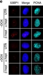 Mouse IgG (H+L) Highly Cross-Adsorbed Secondary Antibody in Immunocytochemistry (ICC/IF)