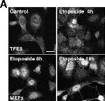 Rabbit IgG (H+L) Highly Cross-Adsorbed Secondary Antibody in Immunocytochemistry (ICC/IF)