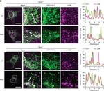 Mouse IgG (H+L) Highly Cross-Adsorbed Secondary Antibody in Immunocytochemistry (ICC/IF)