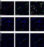 Rabbit IgG (H+L) Highly Cross-Adsorbed Secondary Antibody in Immunohistochemistry (Paraffin) (IHC (P))