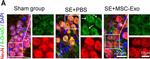 Rabbit IgG (H+L) Highly Cross-Adsorbed Secondary Antibody in Immunohistochemistry (IHC)