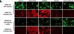 Rabbit IgG (H+L) Cross-Adsorbed Secondary Antibody in Immunocytochemistry (ICC/IF)