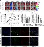 CD31 (PECAM-1) Antibody in Immunohistochemistry (IHC)