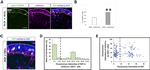 Ki-67 Antibody in Immunohistochemistry (IHC)