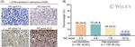 CCT6A Antibody in Immunohistochemistry (IHC)