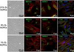 Nkx2.5 Antibody in Immunocytochemistry (ICC/IF)