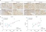 HK2 Antibody in Immunohistochemistry (IHC)