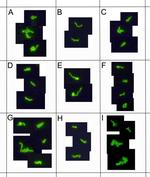 Borrelia burgdorferi Antibody in Immunocytochemistry (ICC/IF)