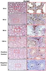 PLCB2 Antibody in Immunohistochemistry (IHC)