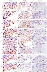 PLCB2 Antibody in Immunohistochemistry (IHC)