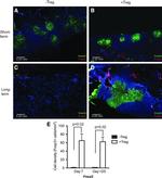 FOXP3 Antibody in Immunohistochemistry (IHC)