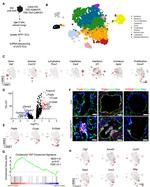 CRYAB Antibody in Immunohistochemistry, Immunohistochemistry (Paraffin) (IHC, IHC (P))