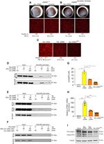 Digoxin Antibody in Immunoprecipitation (IP)