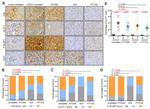 Carbonic Anhydrase IX Antibody in Immunohistochemistry (IHC)