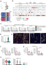 CXCL13 Antibody in Immunohistochemistry (IHC)