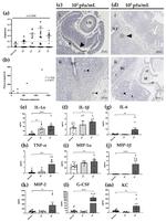 Herpes Simplex Virus Type 1/2 Antibody in Immunohistochemistry (IHC)