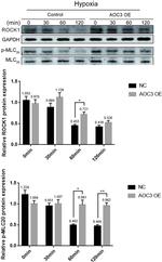 ROCK1 Antibody in Western Blot (WB)