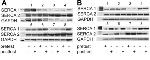 SERCA2 ATPase Antibody in Western Blot (WB)