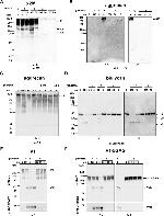 Aggrecan Antibody in Western Blot (WB)